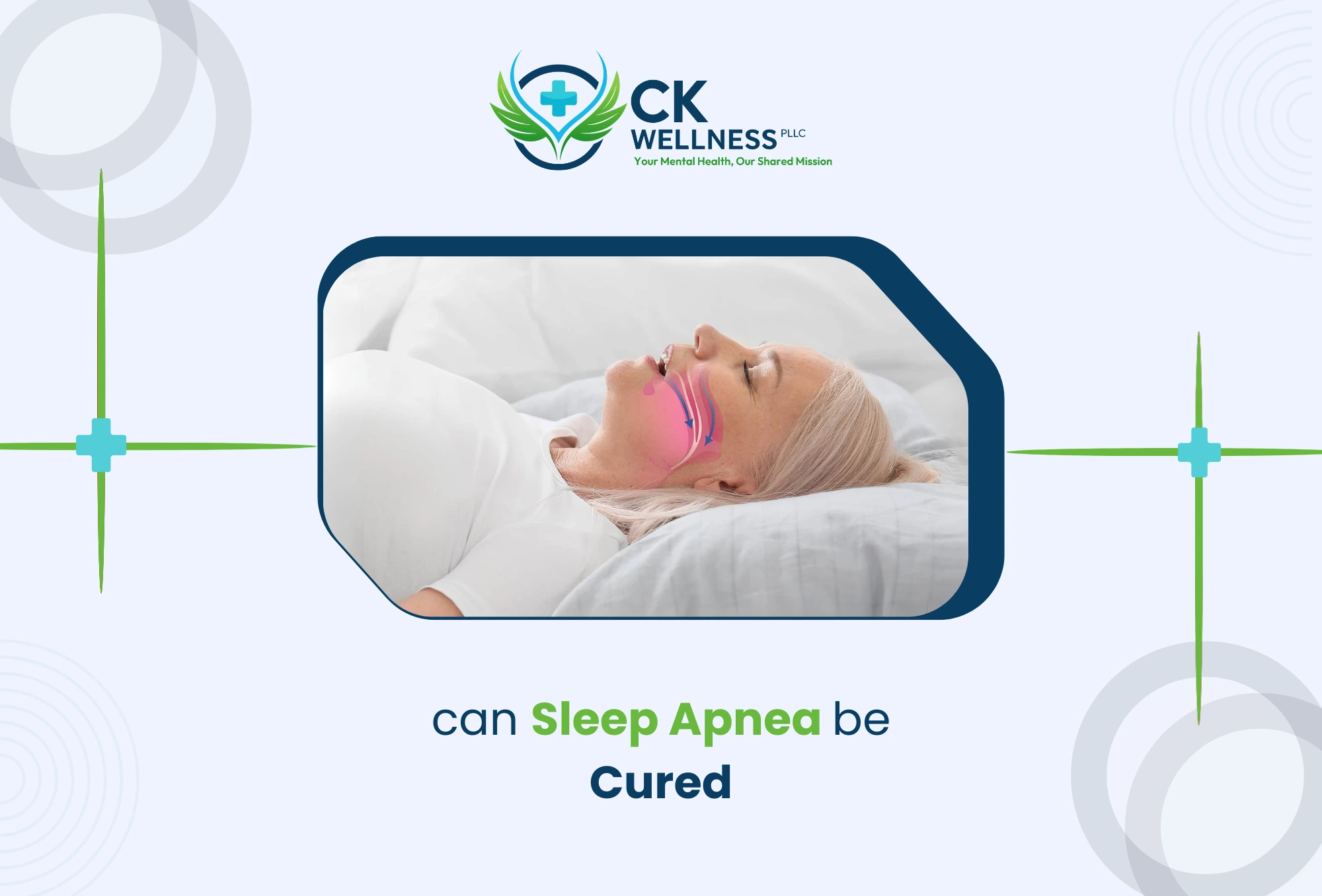 Can Sleep Apnea Be Cured?